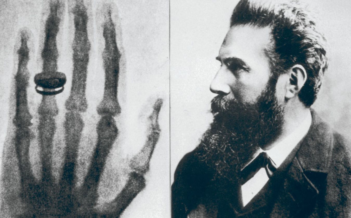 Wilhelm Röntgen et la Révolution des Rayons X : La Naissance de la Radiographie